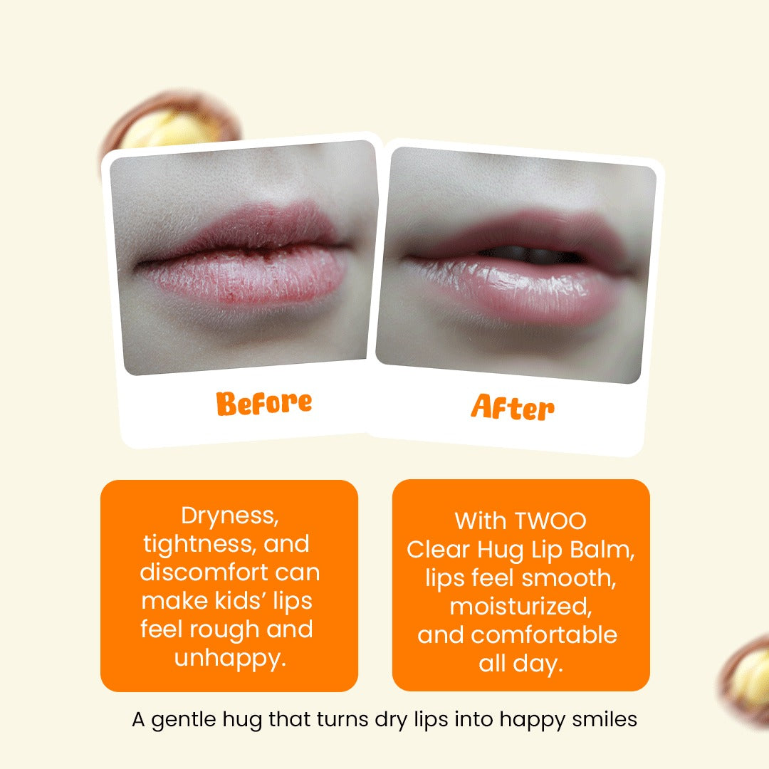 TWOO Moisturizing Clear Hug Lip Balm | Shea Butter | 5g