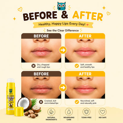 Clear Hug Lip Balm